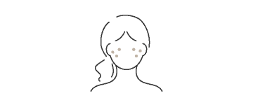 しみ・そばかす